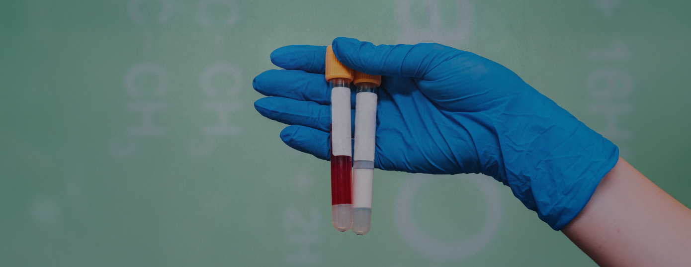 tests de dépistage de drogues