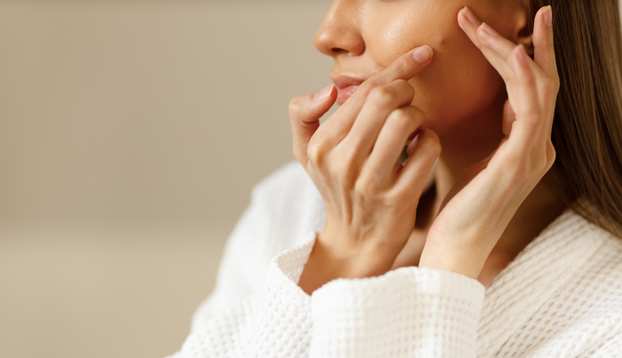 Woman with a pimple on her cheeck